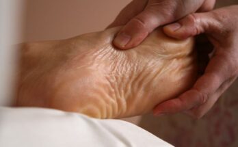 Physiotherapeuten wählen